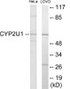 Cytochrome P450 2U1 Colorimetric Cell-Based ELISA