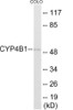 Cytochrome P450 4B1 Colorimetric Cell-Based ELISA