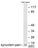 Synuclein-pan In-Cell ELISA