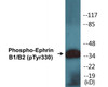 Ephrin B1/B2 Phospho-Tyr330 Colorimetric Cell-Based ELISA Kit