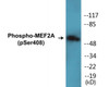 MEF2A Phospho-Ser408 Colorimetric Cell-Based ELISA Kit