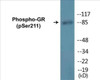 GR Phospho-Ser211 Colorimetric Cell-Based ELISA Kit