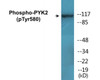 PYK2 Phospho-Tyr580 Colorimetric Cell-Based ELISA Kit