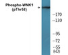 WNK1 Phospho-Thr58 Colorimetric Cell-Based ELISA Kit