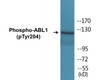 ABL1 Phospho-Tyr204 Colorimetric Cell-Based ELISA Kit