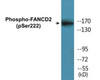 FANCD2 Phospho-Ser222 Colorimetric Cell-Based ELISA Kit