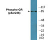 GR Phospho-Ser226 Colorimetric Cell-Based ELISA Kit
