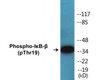 IkappaB-beta Phospho-Thr19 Colorimetric Cell-Based ELISA Kit