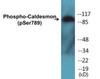 Caldesmon Phospho-Ser789 Colorimetric Cell-Based ELISA Kit