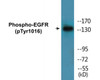 EGFR Phospho-Tyr1016 Colorimetric Cell-Based ELISA Kit