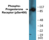 Progesterone Receptor Phospho-Ser400 Colorimetric Cell-Based ELISA Kit