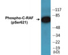 C-RAF Phospho-Ser621 Colorimetric Cell-Based ELISA Kit