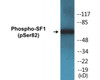 SF1 Phospho-Ser82 Colorimetric Cell-Based ELISA Kit