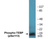 TEBP Phospho-Ser113 Colorimetric Cell-Based ELISA Kit