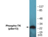 TK Phospho-Ser13 Colorimetric Cell-Based ELISA Kit