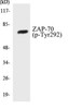 ZAP-70 Phospho-Tyr292 Colorimetric Cell-Based ELISA Kit