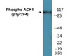 ACK1 Phospho-Tyr284 Colorimetric Cell-Based ELISA Kit