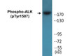 ALK Phospho-Tyr1507 Colorimetric Cell-Based ELISA Kit