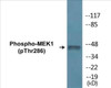 MEK1 Phospho-Thr286 Colorimetric Cell-Based ELISA Kit
