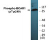 BCAR1 Phospho-Tyr249 Colorimetric Cell-Based ELISA Kit