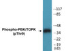 PBK/TOPK Phospho-Thr9 Colorimetric Cell-Based ELISA Kit