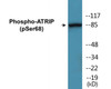 ATRIP Phospho-Ser68 Colorimetric Cell-Based ELISA Kit