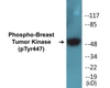 Breast Tumor Kinase Phospho-Tyr447 Colorimetric Cell-Based ELISA Kit