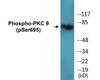 PKC theta Phospho-Ser695 Colorimetric Cell-Based ELISA Kit