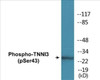 TNNI3 Phospho-Ser43 Colorimetric Cell-Based ELISA Kit