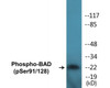 BAD Phospho-Ser91/128 Colorimetric Cell-Based ELISA Kit