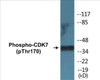 CDK7 Phospho-Thr170 Colorimetric Cell-Based ELISA Kit
