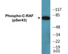 C-RAF Phospho-Ser43 Colorimetric Cell-Based ELISA Kit