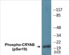 CRYAB Phospho-Ser19 Colorimetric Cell-Based ELISA Kit