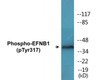 EFNB1 Phospho-Tyr317 Colorimetric Cell-Based ELISA Kit