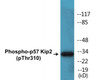 p57 Kip2 Phospho-Thr310 Colorimetric Cell-Based ELISA Kit