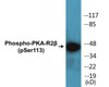 PKA-R2beta Phospho-Ser113 Colorimetric Cell-Based ELISA Kit