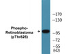 Retinoblastoma Phospho-Thr826 Colorimetric Cell-Based ELISA Kit