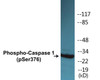 Caspase 1 Phospho-Ser376 Colorimetric Cell-Based ELISA Kit