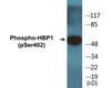 HBP1 Phospho-Ser402 Colorimetric Cell-Based ELISA Kit