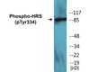 HRS Phospho-Tyr334 Colorimetric Cell-Based ELISA Kit