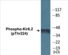 Kir6.2 Phospho-Thr224 Colorimetric Cell-Based ELISA Kit