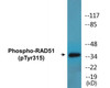 RAD51 Phospho-Tyr315 Colorimetric Cell-Based ELISA Kit