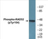 RAD52 Phospho-Tyr104 Colorimetric Cell-Based ELISA Kit