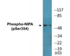 NIPA Phospho-Ser354 Colorimetric Cell-Based ELISA Kit