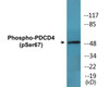 PDCD4 Phospho-Ser67 Colorimetric Cell-Based ELISA Kit