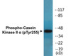 Casein Kinase II alpha Phospho-Tyr255 Colorimetric Cell-Based ELISA Kit