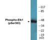 Elk1 Phospho-Ser383 Colorimetric Cell-Based ELISA Kit