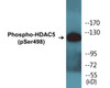 HDAC5 Phospho-Ser498 Colorimetric Cell-Based ELISA Kit