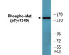 Met Phospho-Tyr1349 Colorimetric Cell-Based ELISA Kit