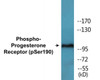 Progesterone Receptor Phospho-Ser190 Colorimetric Cell-Based ELISA Kit